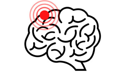 Ostéopathie et commotion cérébrale